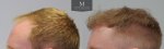 ID1257_Before_After_left.jpg