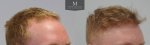 ID1257_Before_After_right_45.jpg