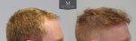 ID1257_Before_After_right.jpg