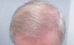 Farjo Hair Institute3.jpeg