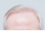 Farjo Hair Institute6.jpeg
