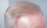 Farjo Hair Institute1.jpeg
