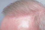 Farjo Hair Institute2.jpeg
