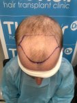 The Hair Doctor Leeds.jpg