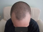 tn_PreSurgery2.jpg