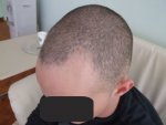 tn_PreSurgery4.jpg