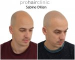 Jonas rechts.jpg Jonas rechts.jpg