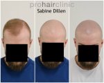 Tired of dealing with hair and hair loss.jpg