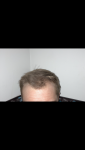 before.PNG