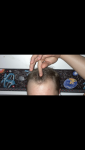 before hairline.PNG