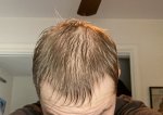 before.jpg