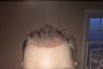frontal.jpg