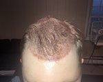 top frontal.jpg