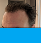 Wet hair front.png