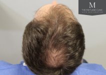 The Maitland Clinic - Before_crown.jpg