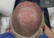 The Maitland Clinic_surgery-crown.jpg