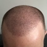 Day 12 update_IMG_7188.jpg