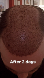 The Hair Dr Leeds.png