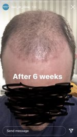 The Hair Dr Leeds1.jpeg
