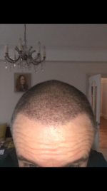 skinhead ht.png