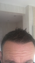 hairline wet.png
