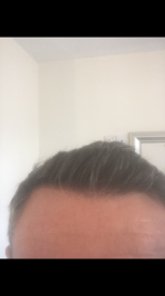 hairline.png
