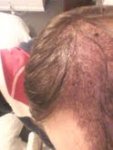 top right side at 2 days.jpg