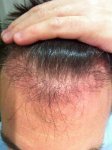 hair pic 4 months.jpg