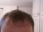 hair front towel dry 2 weeks.jpg