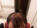 top down hair 24 hrs.jpg
