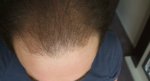 Hair17032012myhouse002.jpg