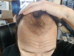 Front Pic 1 14 week.JPG