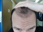 Front Pic 2 14 week.JPG