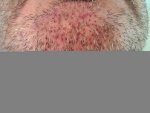 beard 1.jpg