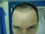 Gel Back.JPG