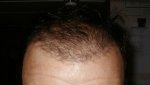 16 WEEK GEL BACK .JPG