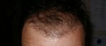 16 Week Gel back 2.JPG