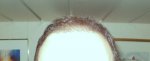 16 week hairline Dry Hair.JPG