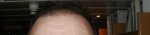 16 week Hairline Wet Hair.JPG
