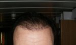 4 Month hair gel back.JPG