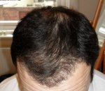 Front Tilt.JPG