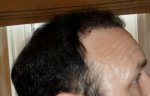 Right Side.JPG