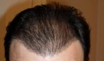 Gel Back Tilt.JPG