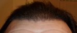 Gel Back 2.JPG
