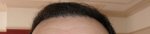 hairline 2.JPG