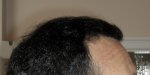 Right Side 6 Month.JPG