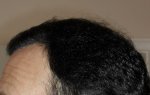 Left Side 6 month.JPG