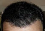 Tilted 6month.JPG
