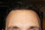 6.5 months Hairline .JPG