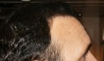 6.5 months Right Side .JPG